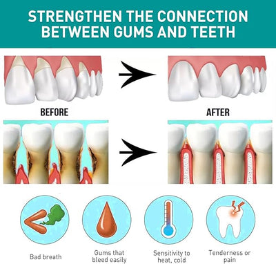 Eelhoe - Mouth Relief Spray (Original)